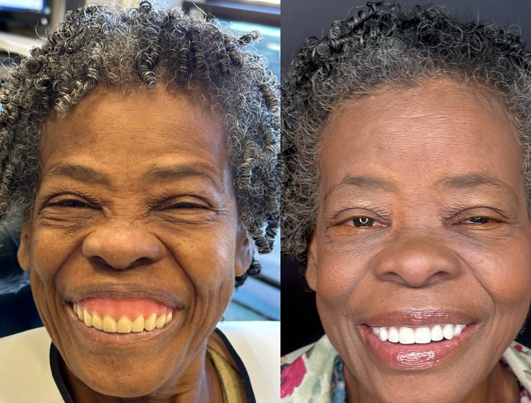 Antes e depois — procedimento 8